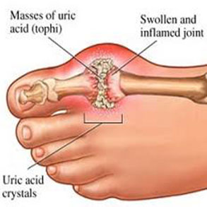 Urological Complain